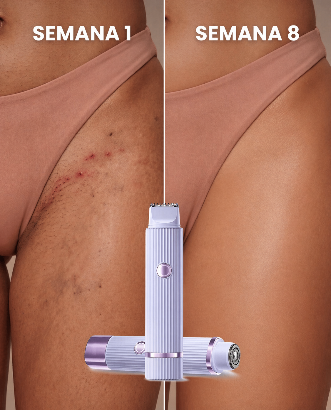 LissPro™ Depilador Elétrico 2 em 1 - Facial e Corporal À Prova d'Água + Brindes Exclusivos